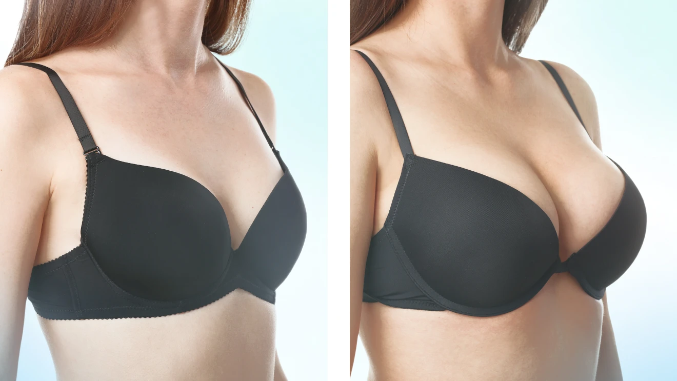 Как отличить настоящую грудь от силиконовой: явные признаки